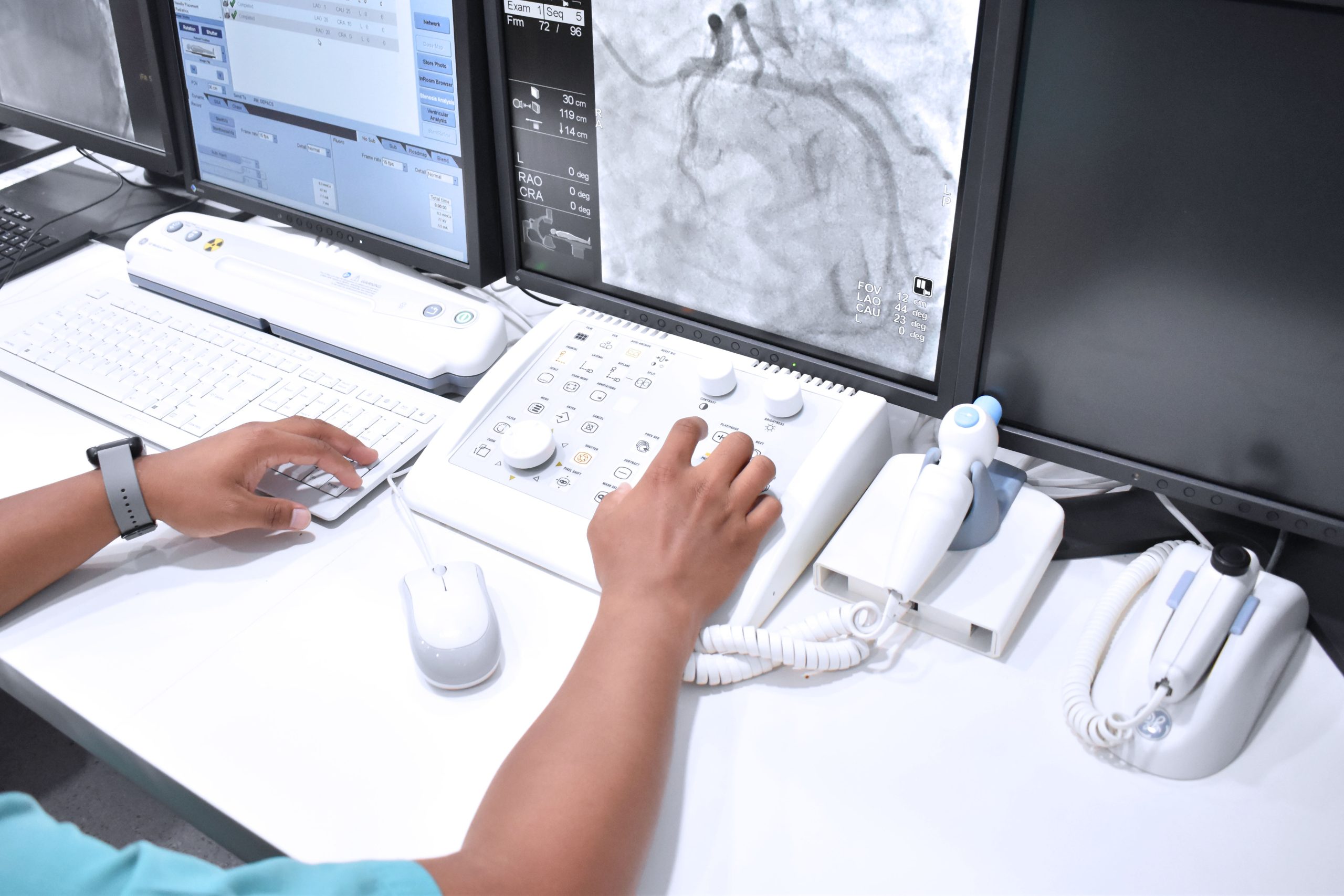 Catheterization Lab: How It Helps Diagnose and Treat Heart Conditions